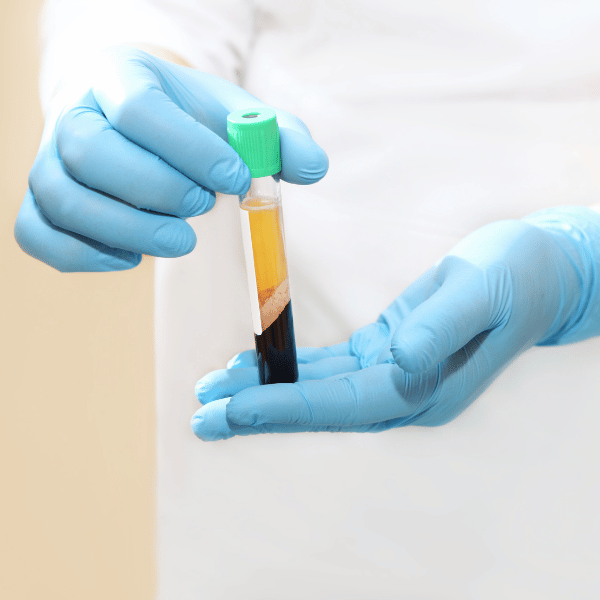 PRP & PRF Therapies (1)